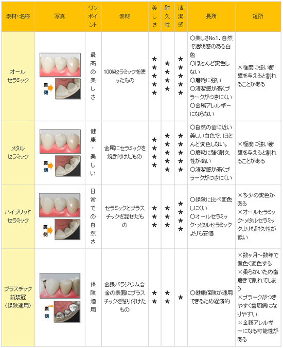 前歯のかぶせもの一覧表